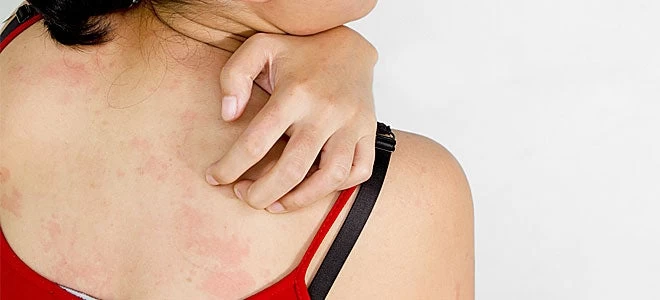 Αυτές οι 8 σοβαρές ασθένειες εκδηλώνουν τα πρώτα σημάδια στο δέρμα – Βίντεο